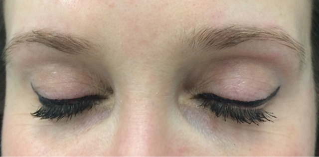 Microblading at the Clinique Anti Aging of Montreal